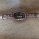 Корпус заднего моста AD1501P/RBP835 б/у - 1